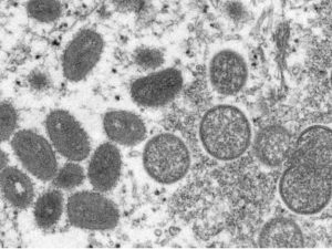 image-62952e5959f9062952e5959f91165394389762952e5959f8c62952e5959f8e