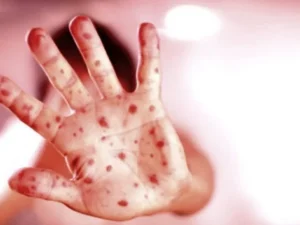 image-image_750x_6596af7add1b8-750-1080-resize